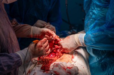 Bir grup cerrah bir hastaya ameliyat yapıyor. Olay yeri yoğun ve dramatik. Cerrahlar hastanın hayatını kurtarmak için birlikte çalışıyorlar.