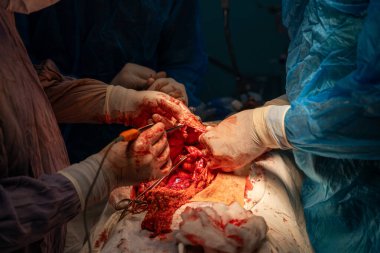 Bir grup cerrah bir hastaya ameliyat yapıyor. Cerrahlar hastanın hayatını kurtarmak için birlikte çalışırken sahne yoğun ve dramatik.