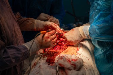 Bir grup cerrah bir hastaya ameliyat yapıyor. Cerrahlar hastanın hayatını kurtarmak için birlikte çalışırken sahne yoğun ve dramatik.