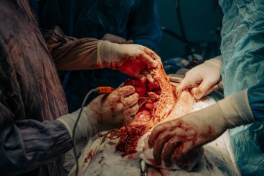 Bir grup cerrah bir hastaya ameliyat yapıyor. Cerrahların hastanın hayatını kurtarmak için birlikte çalıştığı sahne yoğun ve dramatik. Masadaki kan ve vahşet