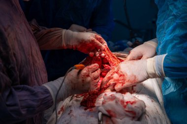 Bir grup cerrah bir hastaya ameliyat yapıyor. Olay yeri yoğun ve dramatik. Cerrahlar hastanın hayatını kurtarmak için birlikte çalışıyorlar.