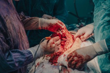 Bir grup cerrah bir hastaya ameliyat yapıyor. Olay yeri yoğun ve dramatik. Cerrahlar hastanın hayatını kurtarmak için birlikte çalışıyorlar.