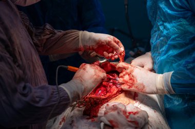 Bir grup cerrah bir hastaya ameliyat yapıyor. Olay yeri yoğun ve dramatik. Cerrahlar hastanın hayatını kurtarmak için birlikte çalışıyorlar.