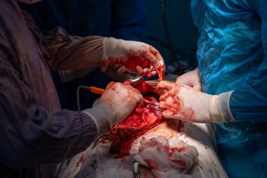 Bir grup cerrah bir hastaya ameliyat yapıyor. Olay yeri yoğun ve dramatik. Cerrahlar hastanın hayatını kurtarmak için birlikte çalışıyorlar.