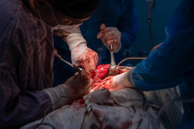 Bir grup cerrah bir hastaya ameliyat yapıyor. Cerrahlar görevlerine odaklandığı için sahne yoğun ve ciddi. Hasta masanın üzerinde yatıyor.