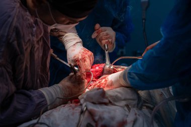 Bir grup cerrah bir hastaya ameliyat yapıyor. Cerrahlar görevlerine odaklandığı için sahne yoğun ve ciddi. Hasta masanın üzerinde yatıyor.