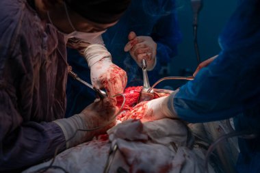 Bir grup cerrah bir hastaya ameliyat yapıyor. Cerrahlar görevlerine odaklandığı için sahne yoğun ve ciddi. Hasta masanın üzerinde yatıyor.