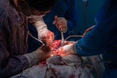 Bir grup cerrah bir hastaya ameliyat yapıyor. Cerrahlar görevlerine odaklandığı için sahne yoğun ve ciddi. Hasta masanın üzerinde yatıyor.