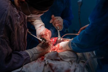 Bir grup cerrah bir hastaya ameliyat yapıyor. Cerrahlar görevlerine odaklandığı için sahne yoğun ve ciddi. Hasta masanın üzerinde yatıyor.