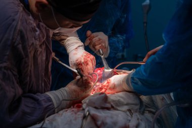 Bir grup cerrah bir hastaya ameliyat yapıyor. Cerrahlar görevlerine odaklandığı için sahne yoğun ve ciddi. Hasta masanın üzerinde yatıyor.