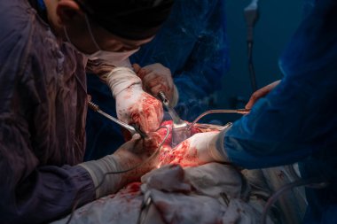 Bir grup cerrah bir hastaya ameliyat yapıyor. Cerrahlar hastanın hayatını kurtarmak için çalışırken atmosfer gergin ve ciddi.