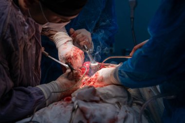 Bir grup cerrah bir hastaya ameliyat yapıyor. Cerrahlar görevlerine odaklandığı için sahne yoğun ve ciddi. Hasta masanın üzerinde yatıyor.