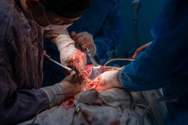 Bir grup cerrah bir hastaya ameliyat yapıyor. Cerrahlar görevlerine odaklandığı için sahne yoğun ve ciddi. Hasta masanın üzerinde yatıyor.