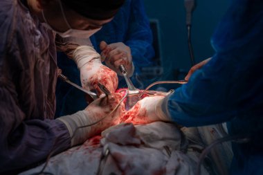 Bir grup cerrah bir hastaya ameliyat yapıyor. Cerrahlar görevlerine odaklandığı için sahne yoğun ve ciddi. Hasta masanın üzerinde yatıyor.