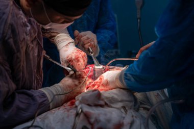 Bir grup cerrah bir hastaya ameliyat yapıyor. Cerrahlar görevlerine odaklandığı için sahne yoğun ve ciddi. Hasta masanın üzerinde yatıyor.