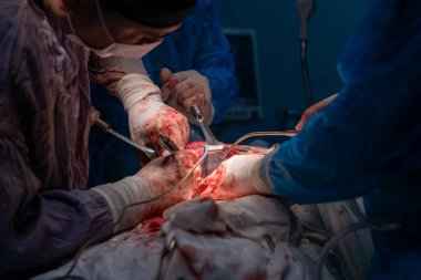 Bir grup cerrah bir hastaya ameliyat yapıyor. Cerrahlar görevlerine odaklandığı için sahne yoğun ve ciddi. Hasta masanın üzerinde yatıyor.