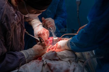 Bir grup cerrah bir hastaya ameliyat yapıyor. Cerrahlar görevlerine odaklandığı için sahne yoğun ve ciddi. Hasta masanın üzerinde yatıyor.