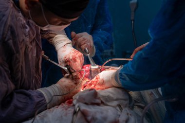 Bir grup cerrah bir hastaya ameliyat yapıyor. Cerrahlar görevlerine odaklandığı için sahne yoğun ve ciddi. Hasta masanın üzerinde yatıyor.