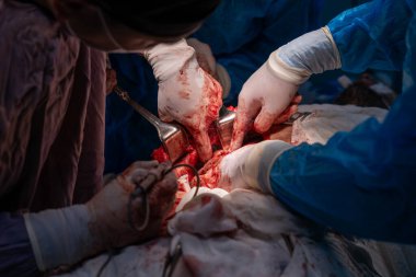 Bir grup cerrah bir hastaya ameliyat yapıyor. Cerrahlar hastanın hayatını kurtarmak için birlikte çalışırken sahne yoğun ve dramatik.