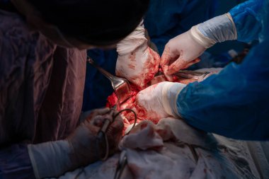 Bir grup cerrah bir hastaya ameliyat yapıyor. Cerrahlar görevlerine odaklandığı için sahne yoğun ve ciddi. Hasta çok acı çekiyor.