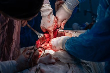 Bir grup cerrah bir hastaya ameliyat yapıyor. Cerrahlar hastanın hayatını kurtarmak için birlikte çalışırken sahne yoğun ve dramatik. Atmosfer ciddi ve odaklı.