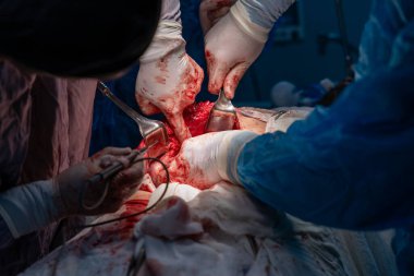 Bir grup cerrah bir hastaya ameliyat yapıyor. Cerrahlar görevlerine odaklandığı için sahne yoğun ve ciddi. Hasta savunmasız bir durumda.