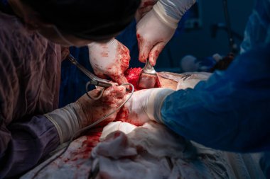 Bir grup cerrah bir hastaya ameliyat yapıyor. Cerrahlar görevlerine odaklandığı için sahne yoğun ve ciddi. Hasta çok acı çekiyor.