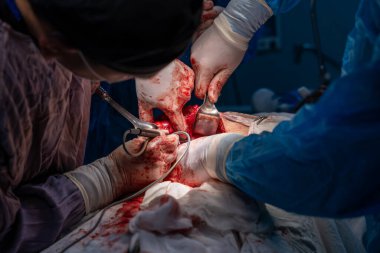 Bir grup cerrah bir hastaya ameliyat yapıyor. Cerrahlar görevlerine odaklandığı için sahne yoğun ve ciddi. Hasta bir hastane yatağında.