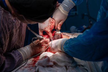 Bir grup cerrah bir hastaya ameliyat yapıyor. Cerrahlar görevlerine odaklandığı için sahne yoğun ve ciddi. Hasta masanın üzerinde yatıyor.