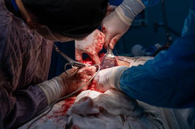 Bir grup cerrah bir hastaya ameliyat yapıyor. Cerrahlar görevlerine odaklandığı için sahne yoğun ve ciddi. Hasta çok acı çekiyor.