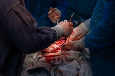 Bir grup cerrah bir hastaya ameliyat yapıyor. Cerrahlar görevlerine odaklandığı için sahne yoğun ve ciddi. Hasta masanın üzerinde yatıyor.