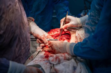 Bir grup cerrah bir hastaya ameliyat yapıyor. Cerrahlar hastanın vücudunu keserken sahne yoğun ve dramatik. Atmosfer ciddi ve odaklı.