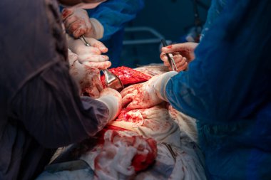 Bir grup cerrah bir hastaya ameliyat yapıyor. Cerrahlar görevlerine ve hastanın hayatı onların ellerinde olduğu için sahne yoğun ve dramatik.