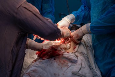 Bir grup cerrah bir hastaya ameliyat yapıyor. Cerrahlar görevlerine odaklandığı için sahne yoğun ve ciddi. Hasta masanın üzerinde yatıyor.