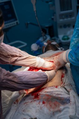 Bir grup cerrah bir hastaya ameliyat yapıyor. Cerrahların hastanın hayatını kurtarmak için birlikte çalıştığı sahne yoğun ve dramatik. Hastanın vücudu kanla kaplı.