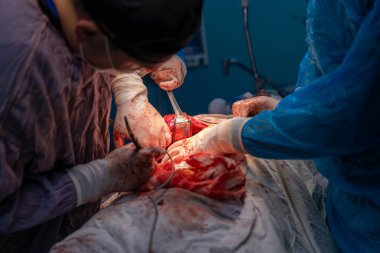 Bir adam neşterle bir cesedi kesiyor. Diğer adam izliyor. Sahne yoğun ve dramatik.