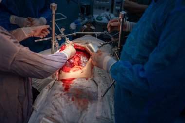 Bir grup cerrah bir hastaya ameliyat yapıyor. Cerrahlar görevlerine odaklandığı için sahne yoğun ve ciddi. Hasta masanın üzerinde yatıyor.