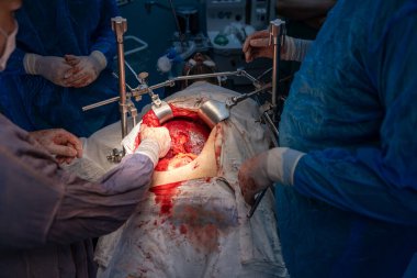 Bir grup cerrah bir hastaya ameliyat yapıyor. Cerrahlar görevlerine odaklandığı için sahne yoğun ve ciddi. Hasta çok acı çekiyor.