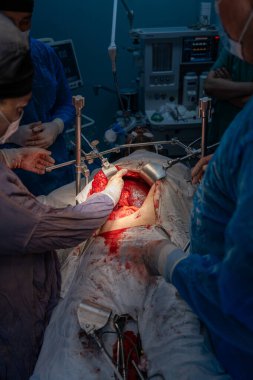 Bir grup cerrah bir hastaya ameliyat yapıyor. Cerrahlar görevlerine odaklandığı için sahne yoğun ve ciddi. Hasta masanın üzerinde yatıyor.