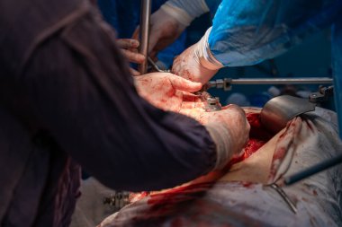 Bir grup cerrah bir hastaya ameliyat yapıyor. Cerrahlar görevlerine odaklandığı için sahne yoğun ve ciddi. Hasta masanın üzerinde yatıyor.