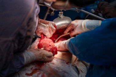 Bir grup cerrah bir hastaya ameliyat yapıyor. Cerrahlar hastanın hayatını kurtarmak için birlikte çalışırken sahne yoğun ve dramatik.