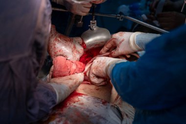 Bir grup cerrah bir hastaya ameliyat yapıyor. Olay yeri yoğun ve dramatik. Cerrahlar hastanın hayatını kurtarmak için birlikte çalışıyorlar.