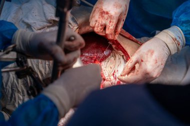 Bir grup cerrah bir hastaya ameliyat yapıyor. Cerrahlar hastanın hayatını kurtarmak için birlikte çalışırken sahne yoğun ve dramatik.