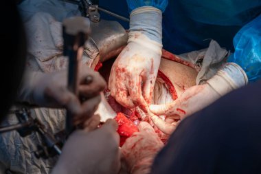 Bir grup cerrah bir hastaya ameliyat yapıyor. Cerrahlar hastanın hayatını kurtarmak için birlikte çalışırken sahne yoğun ve dramatik.