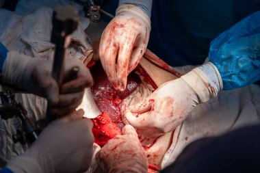 Bir grup cerrah bir hastaya ameliyat yapıyor. Cerrahlar hastanın hayatını kurtarmak için birlikte çalışırken sahne yoğun ve dramatik.