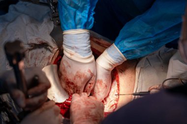 Bir cerrah bir hastaya ameliyat yapıyor. Cerrah hastanın vücudunu keserken sahne yoğun ve dramatik. Odadaki diğer insanlar prosedürü izliyorlar.