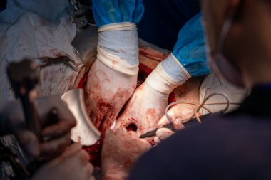 Bir cerrah bir insanın karnını deşiyor. Cerrah ve diğer tıp uzmanları hastanın hayatını kurtarmak için birlikte çalışırken sahne yoğun ve dramatik.