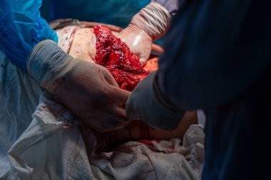 Bir insan bir cesedi bıçakla kesiyor. Sahne kanlı ve dehşet verici. Cesedi kesen kişi eldiven ve ameliyat elbisesi giyiyor.