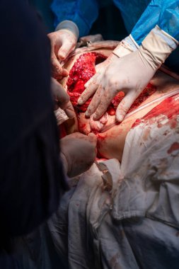 Bir adam bir insanın karnını deşiyor. Sahne kanlı ve dehşet verici. Adam eldiven ve cerrahi maske takıyor. Odadaki diğer insanlar prosedürü izliyorlar.