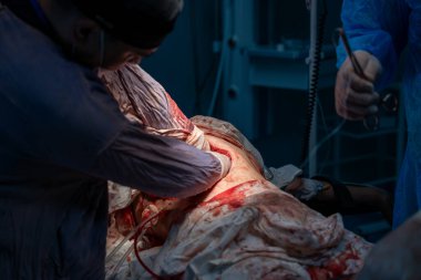 Bir adam bir hastayı ameliyat ediyor. Hastanın vücudu kanla kaplı ve cerrah eldiven giyiyor. Cerrah hastanın hayatını kurtarmak için çalışırken sahne yoğun ve dramatik.